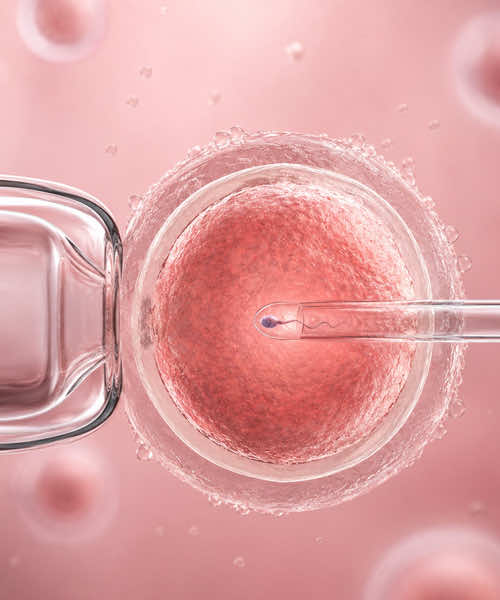 Fertilization & Embryo Culture